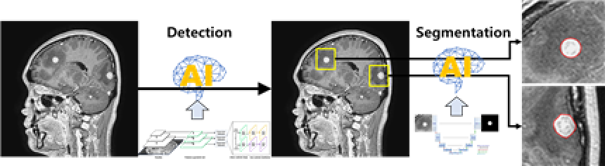 뇌전이암 진단 및 치료 영상-학습 알고리즘_1_RetinaNet network 개념도(1)