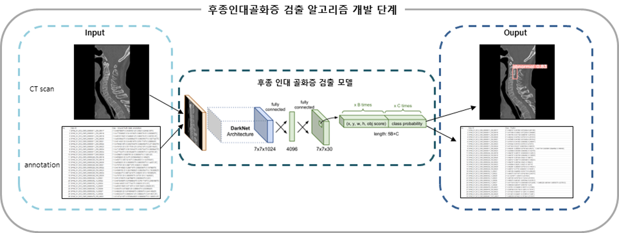 퇴행성 척추질환 진단 및 치료를 위한 멀티모달리티 데이터-후종인대골화증 검출 알고리즘 개발 단계 이미지