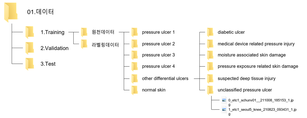 단계별 욕창 환부 이미지-데이터 구성_1_폴더 구조