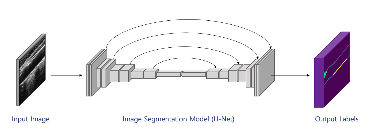당뇨병 및 합병증 추적관찰 임상 데이터-초음파 경동맥 이미지 분할(Segmentation) 모델 개발_1