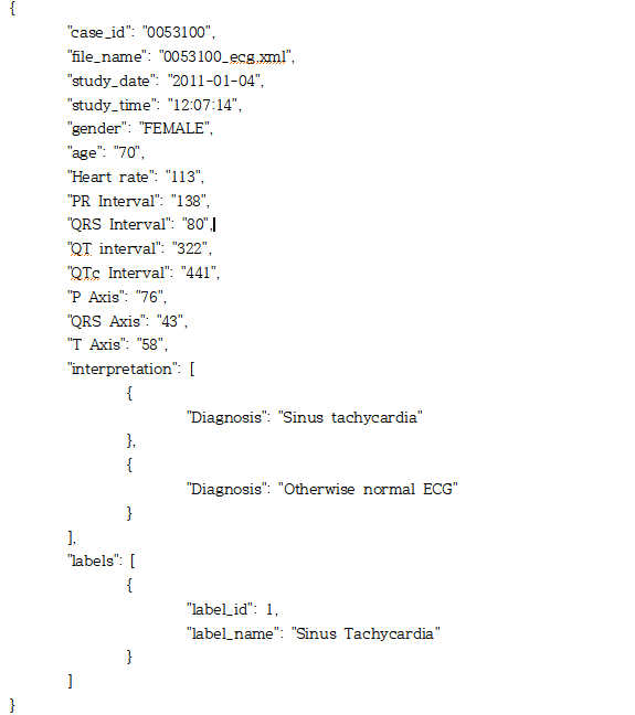 심장질환 진단을 위한 심전도 데이터-라벨링 데이터 실제 예시_1_심전도 데이터 라벨링 예시