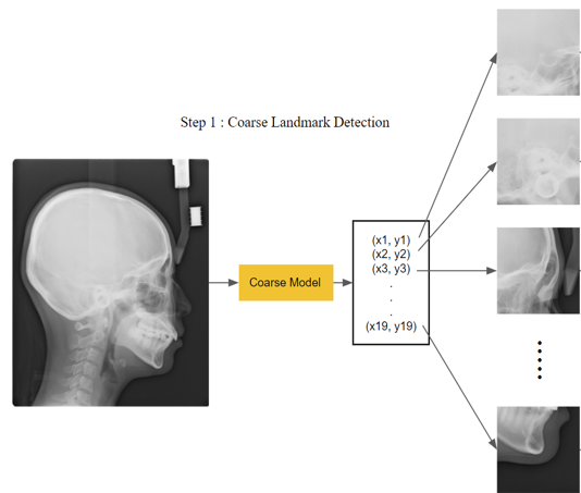 측면두부규격방사선사진(cephalography)-AI 기반 측면두부규격방사선 분석 모델-모델 설계-대략적인 랜드마크 좌표 추출 모델(1단계)