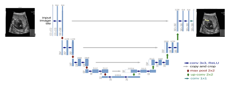 임신중 태아 초음파 영상 데이터-활용 모델_1_U-Net 활용