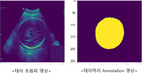 임신중 태아 초음파 영상 데이터-데이터셋의 종류 및 형식_1_원본 및 라벨링 데이터 예시