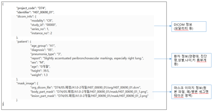 소아 흉부 이미지 데이터-Annotation 데이터 구조 예시_1