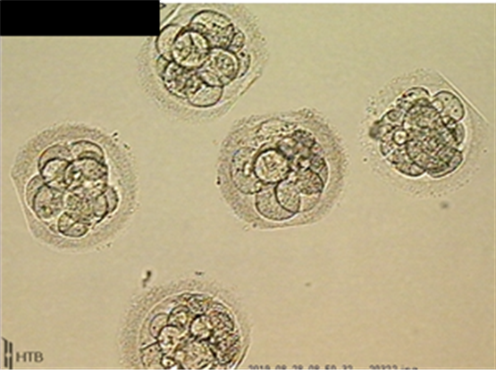 배아 이미지