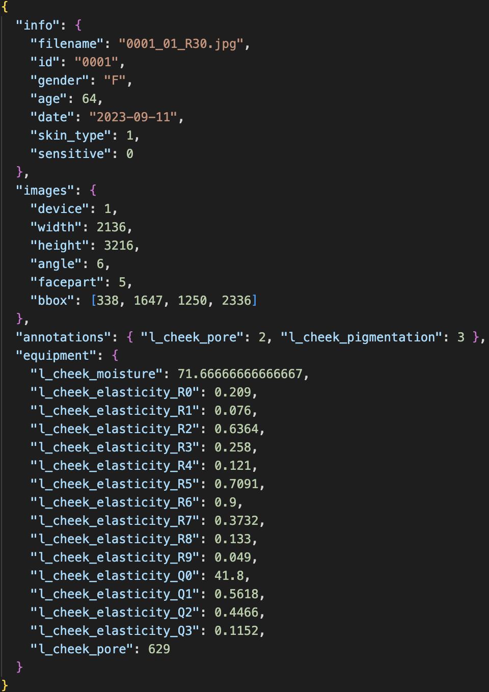 JSON 파일 예시 이미지